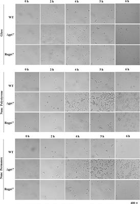 Deficiency of GPI Glycan Modification by Ethanolamine Phosphate Results in Increased Adhesion and Immune Resistance of Aspergillus fumigatus